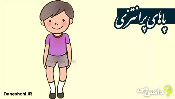 تحقیق درباره پاهای پرانتزی