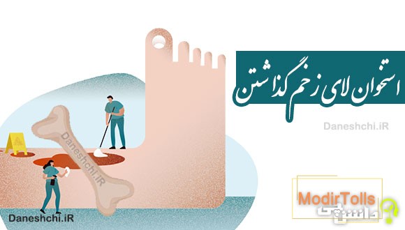 استخوان لای زخم گذاشتن