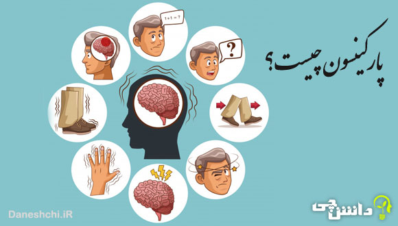 بیماری پارکینسون