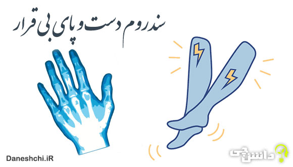 تحقیق در مورد سندروم دست بی قرار و سندروم پای بی قرار