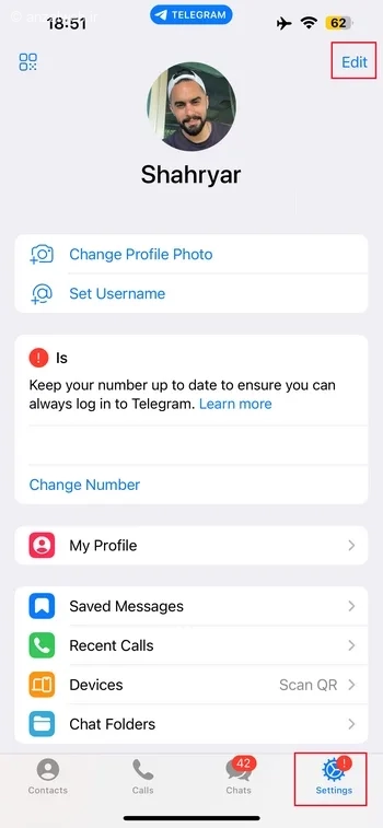 گزینه Edit بالا