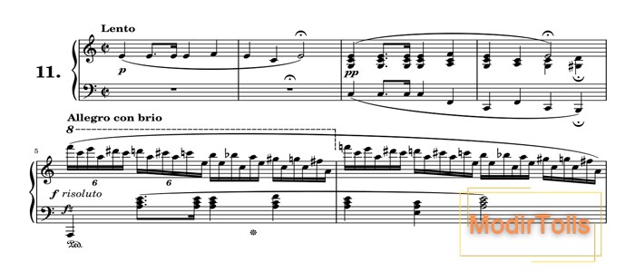اتود در موسیقی چیست